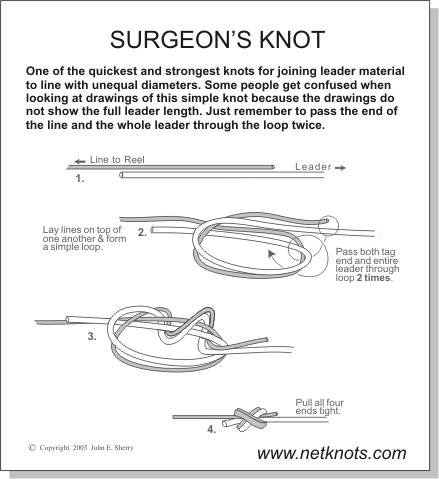 surgeons_knot